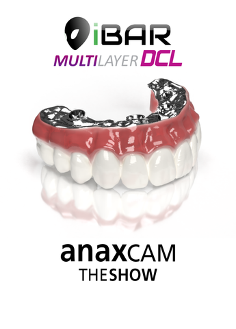 Alien iBar X AnaxCAM Multi-Layer DCL