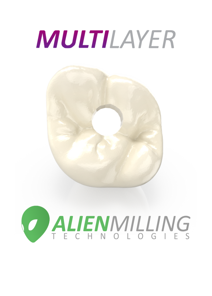 Alien Multi-Layer Implant Zirconia Crown