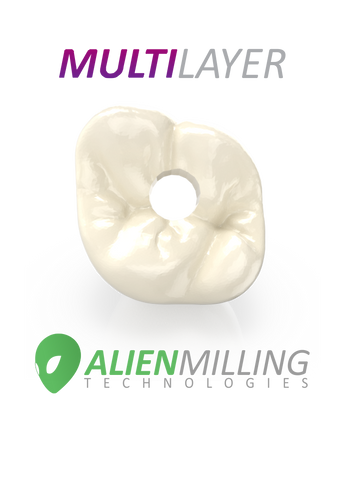 Alien Multi-Layer Implant Zirconia Crown